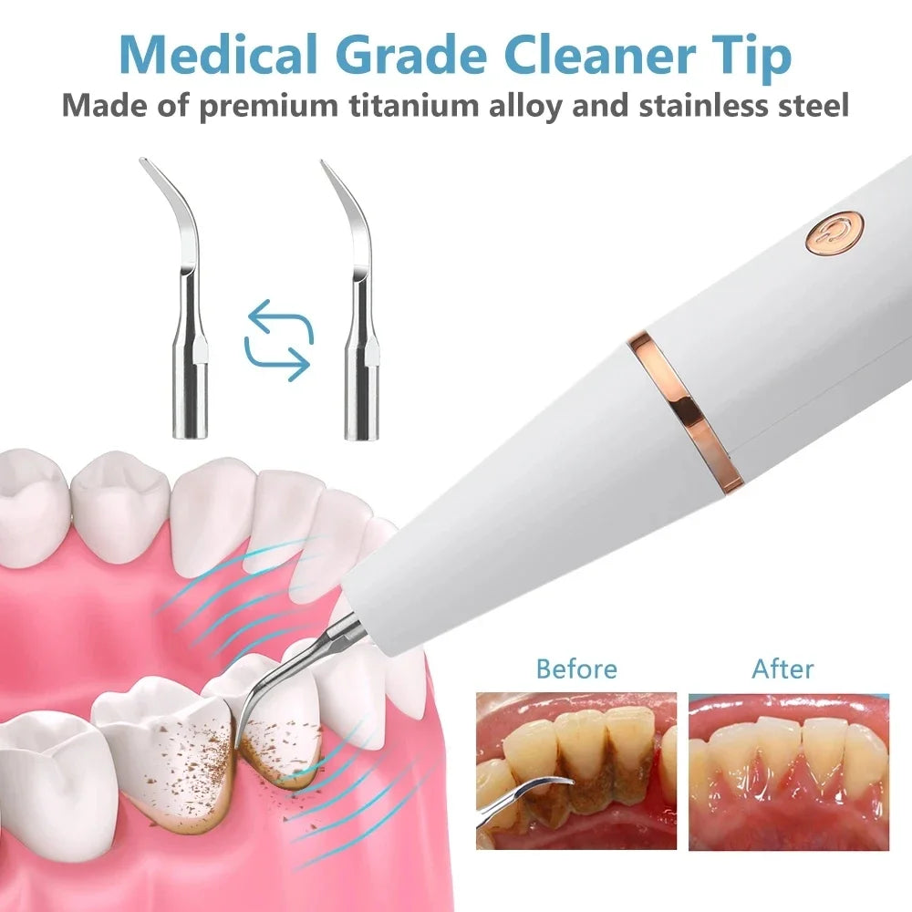 Ultrasonic Tooth Cleaner Tartar Scaler Device