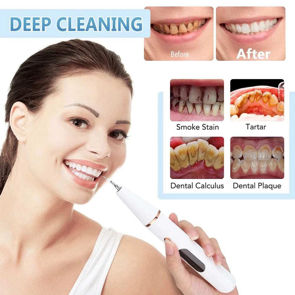 Ultrasonic Tooth Cleaner Tartar Scaler Device