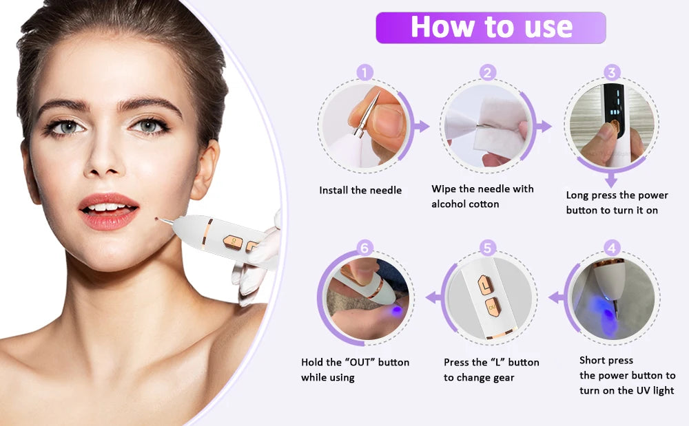 Plasma Pen Mole & Skin Tag Remover Device