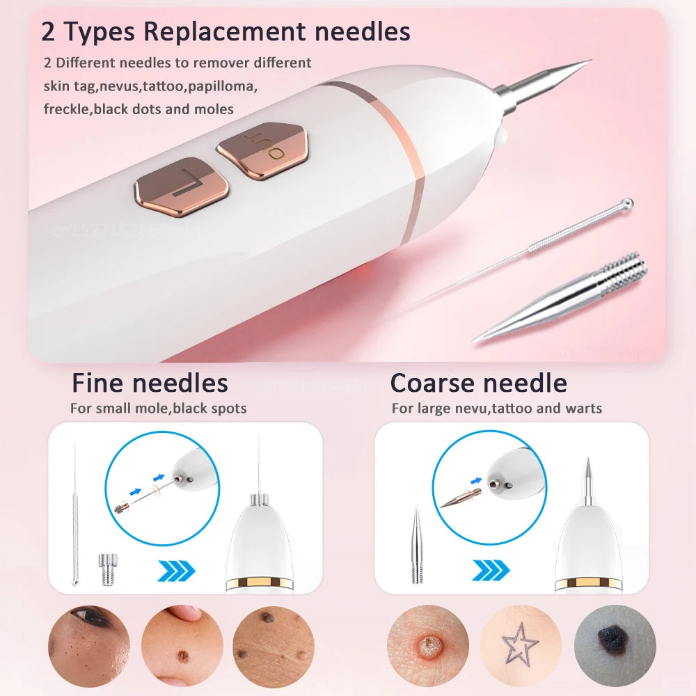 Plasma Pen Mole & Skin Tag Remover Device