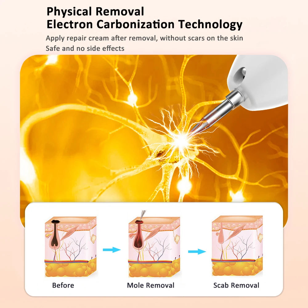 Plasma Pen Mole & Skin Tag Remover Device